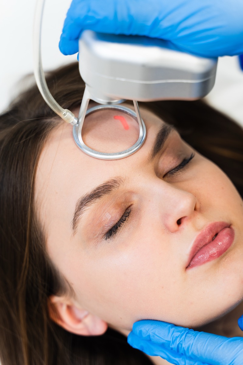 Laser treatment for pigmentation and scarring